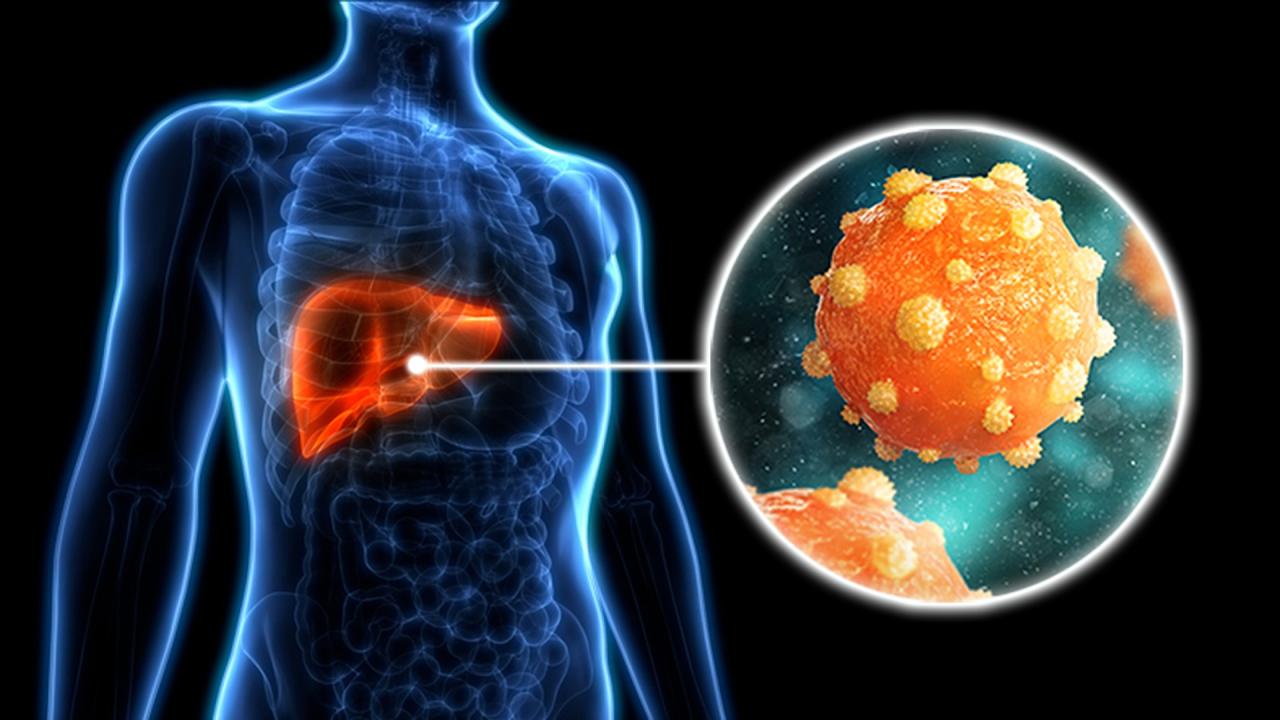 Penyakit Hepatitis Sebagai Isu Global